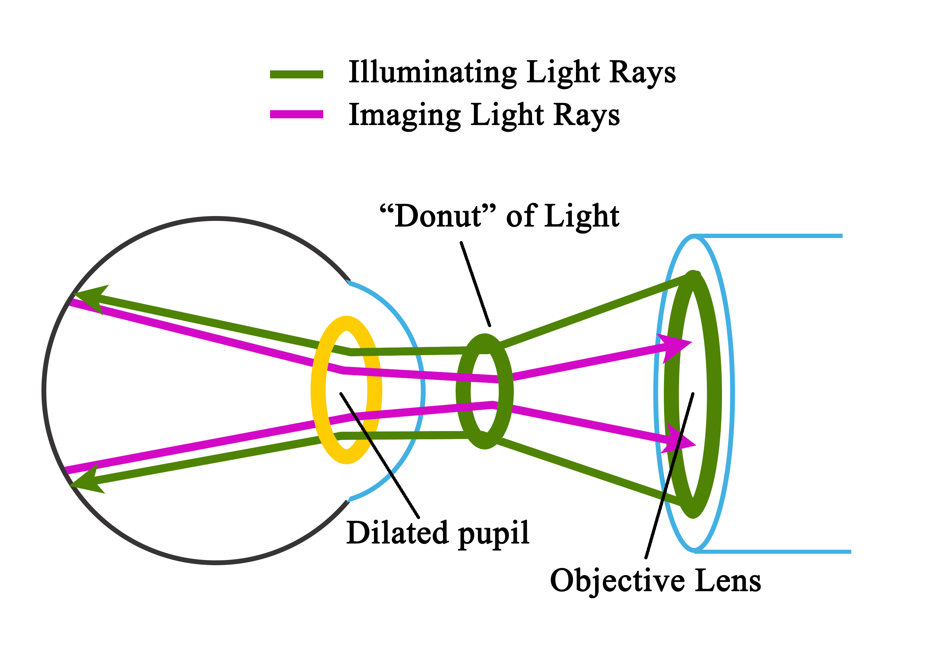 Illumination and imaging of the retina through the pupil