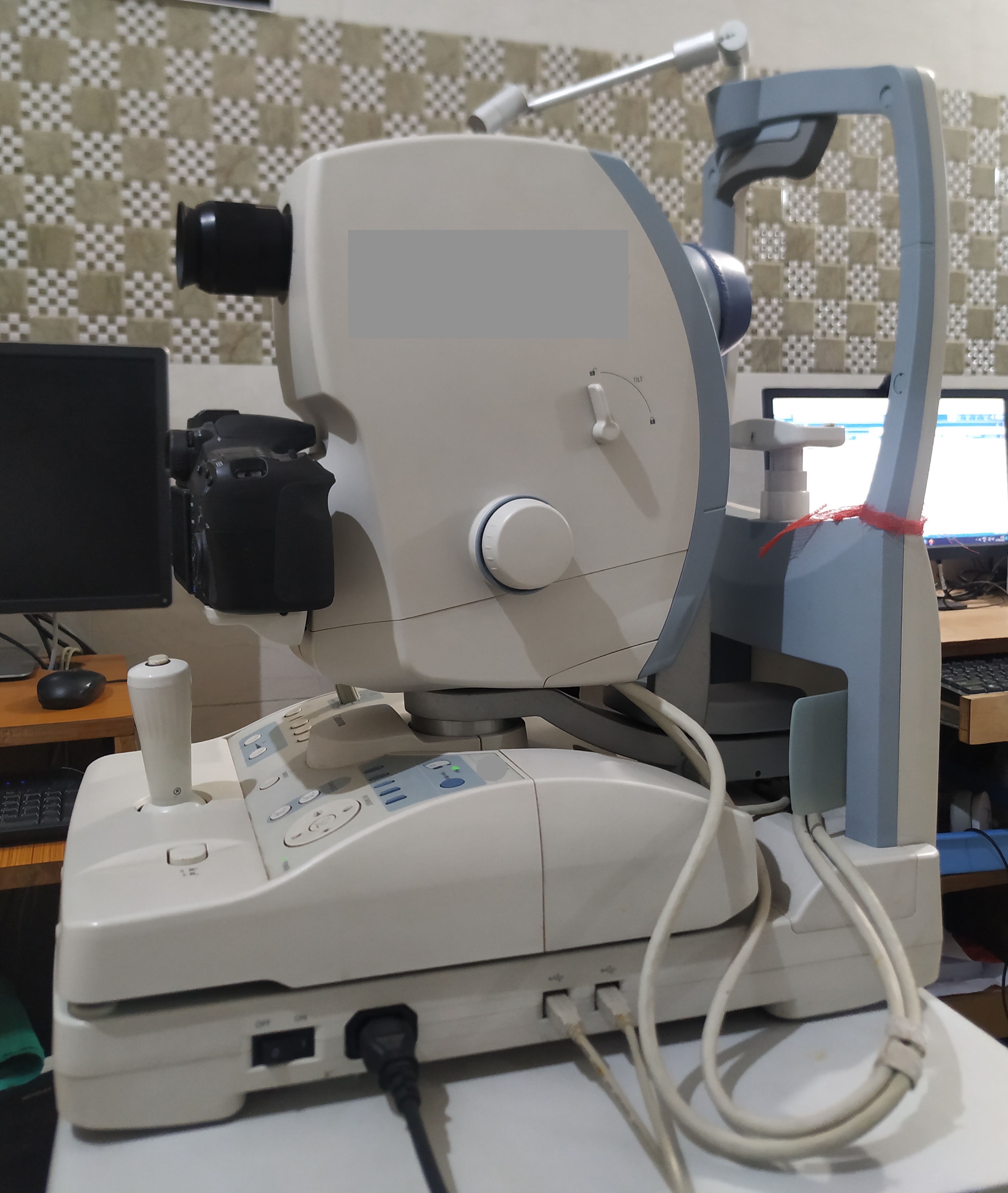 A Fundus camera in the clinic