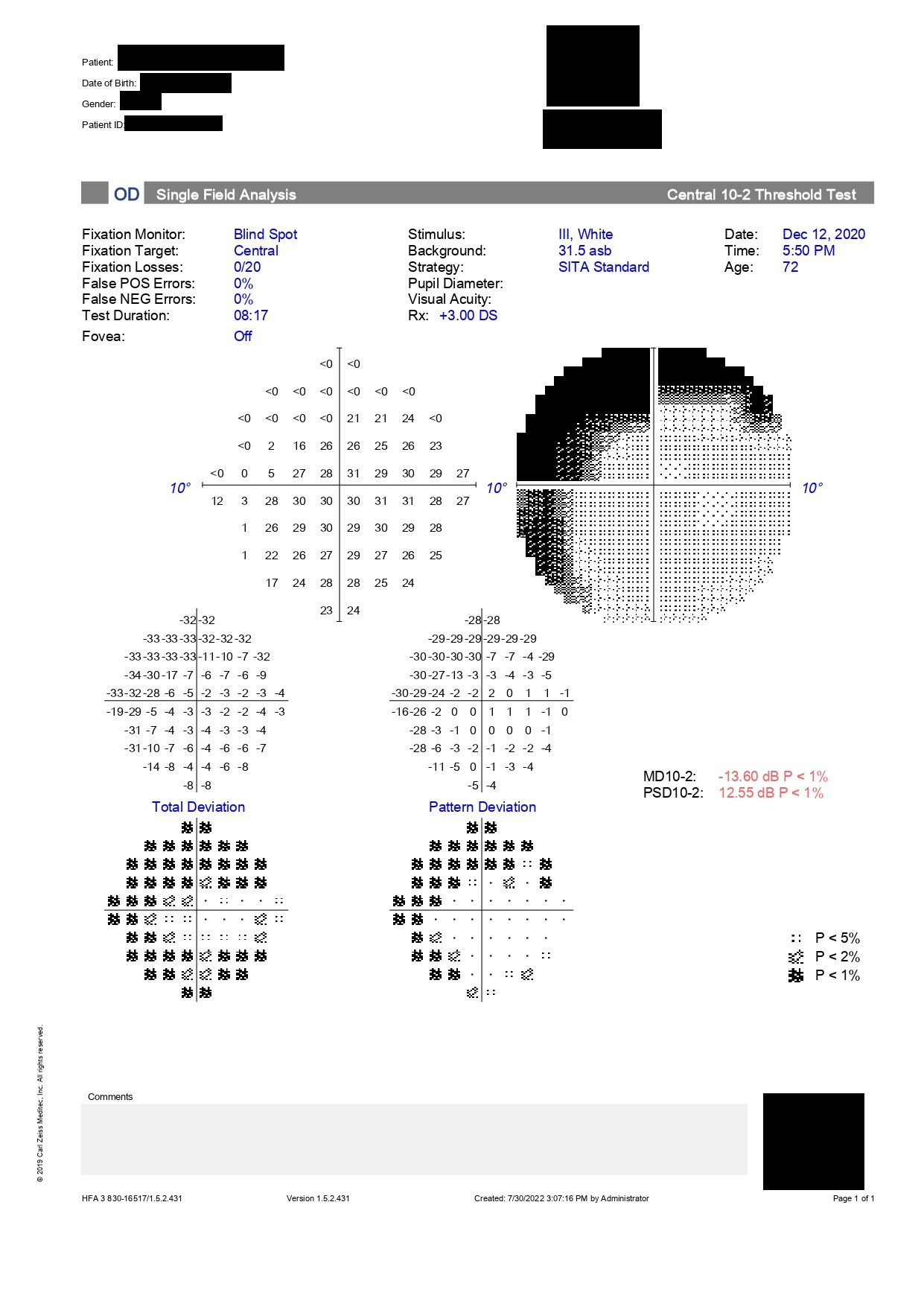 Humphrey visual field printout (10-2 test)