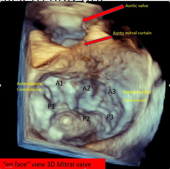 En Face view of mitral valve by 3 D TEE