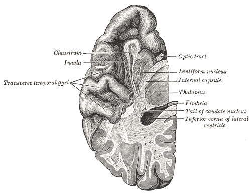 Section of brain showing upper surface of temporal lobe, Claustrum, Insula, Transverse temporal gyri, Optic tract, Lentiform nucleus, Internal capsule, Thalamus, Fimbria, Tail of Caudate Nucleus, Inferior Cornu of lateral ventricle, 