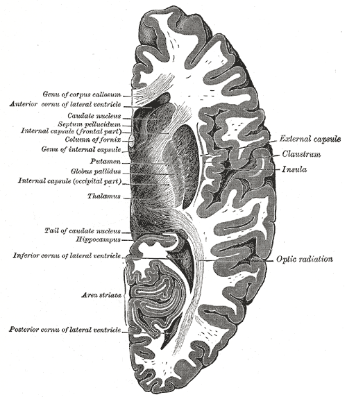 Horizontal section of right cerebral hemisphere, Genu of Corpus callosum, Anterior cornua of lateral ventricle, Caudate nucleus, Septum pellucidum, Internal capsule (frontal part), Column of fornix, Genu of internal capsule, Putamen, Globus pallidus, Internal capsule (occipital part), Thalamus, Tail of caudate nucleus, Hippocampus, Inferior cornua of lateral ventricle, Area striata, Posterior cornua of lateral ventricle, Optic Radiation, Insula, Claustrum, External capsule