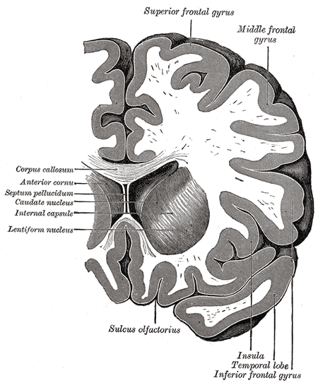 Coronal section through anterior cornua of lateral ventricles, Superior frontal gyrus, Middle Frontal Gyrus, Corpus callosum, Anterior cornua, Septum pellucidum, Caudate nucleus, Internal capsule, Lentiform nucleus, Sulcus olfactorius, Insula, Temporal lobe, Inferior Frontal gyrus