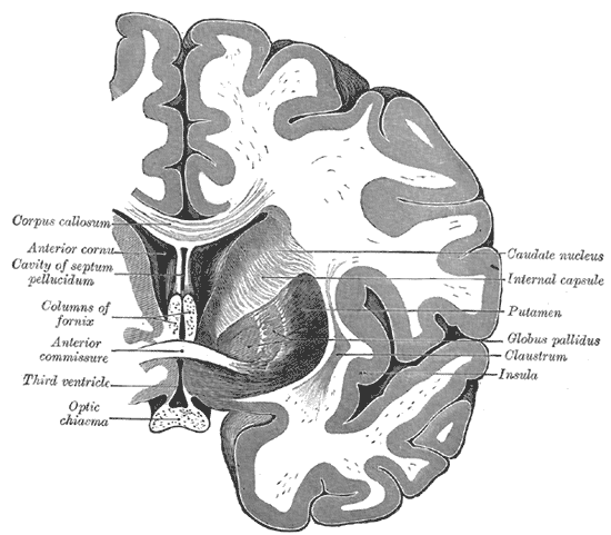 Coronal section of brain through anterior commissure, Caudate nucleus, Internal Capsule, Putamen, Globus pallidus, Claustrum, Insula, Optic Chiasma, Third Ventricle, Anterior Commissure, Columns of fornix, Cavity of septum pellucidum, ANterior Cornu, Corpus callosum