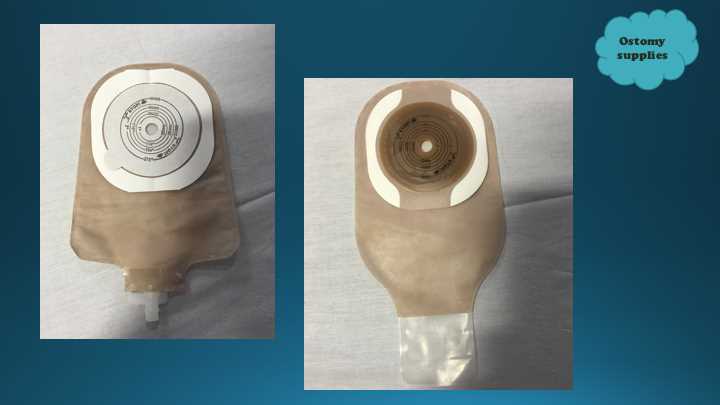Ostomy care product examples of pouches for ileostomy and colostomy, Round tip is for liquid stool and square is for more formed stool. 