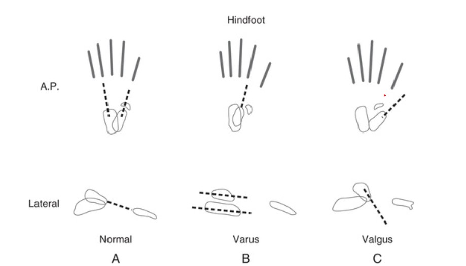 Hindfoot and forefoot relationships in the anteroposterior and lateral projections.