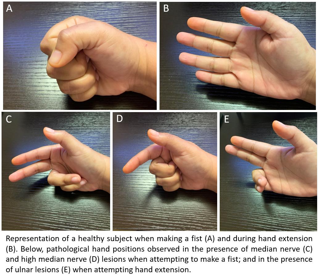 <p>Hand Positions