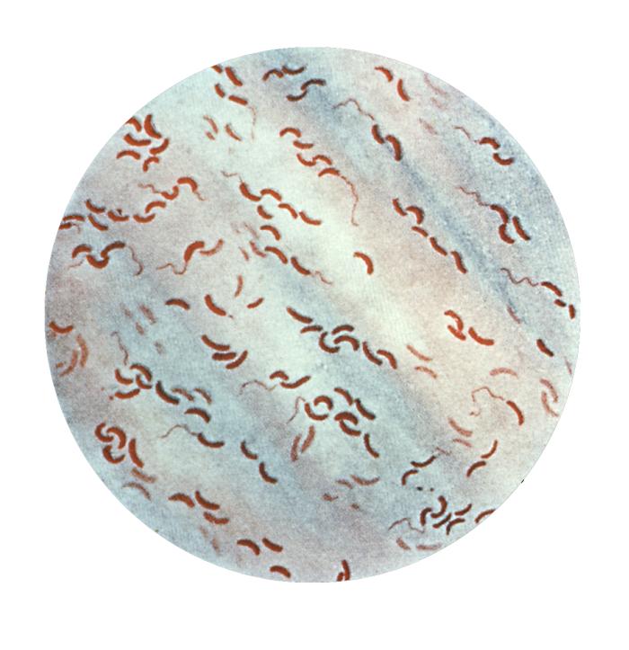 <p>Vibrio cholerae