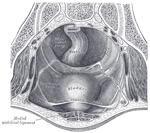 The Abdomen, The peritoneum of the male pelvis, Medial umbilical ligament, Rectum, Bladder, Pararectal fossa, Paravesical fossa, Ductus deferens 
