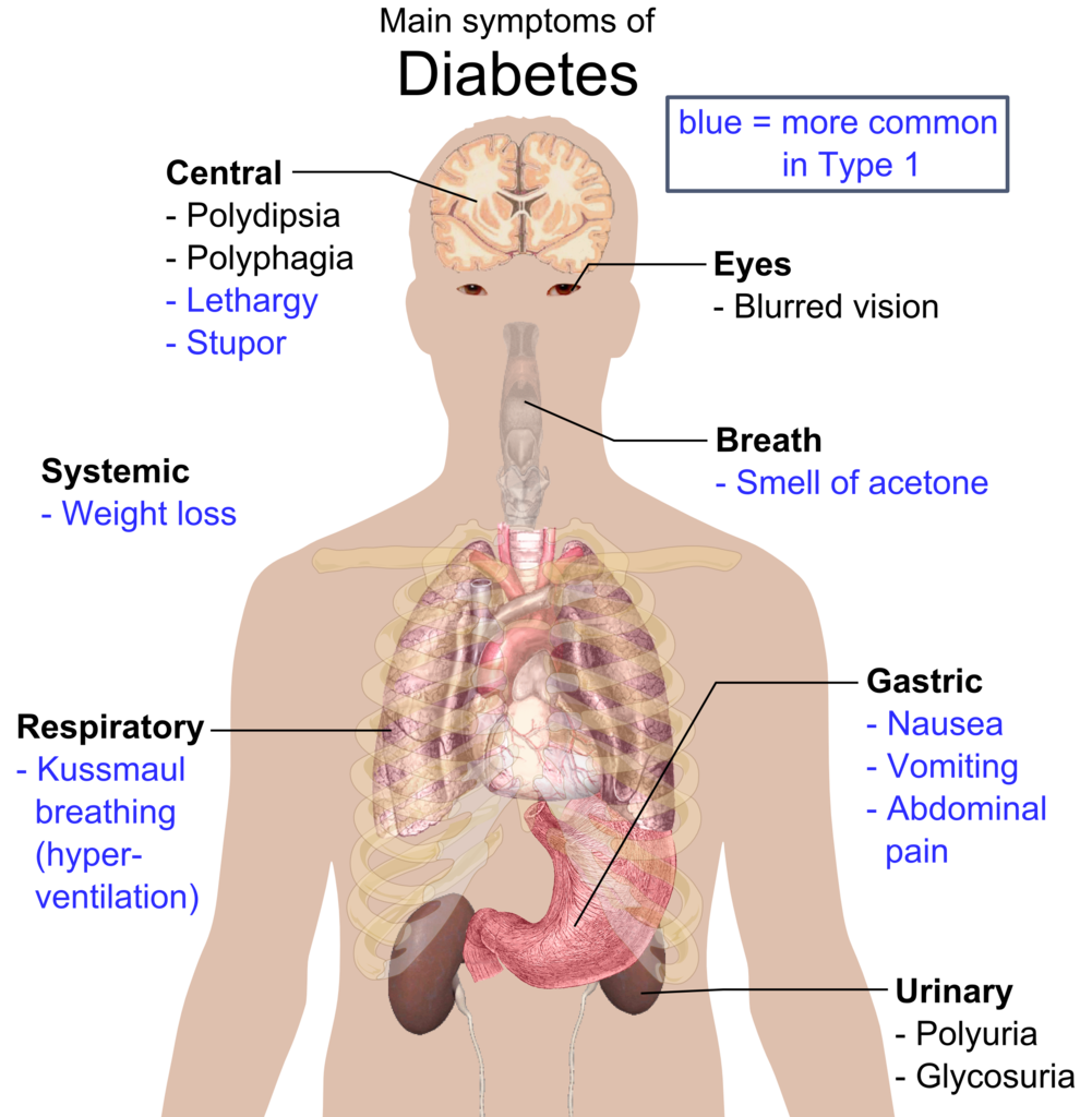 Overview of the most significant possible symptoms of diabetes