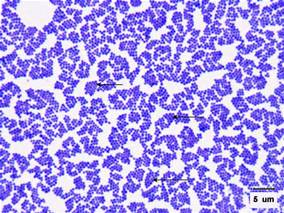 Gram stain of Staphylococcus aureus