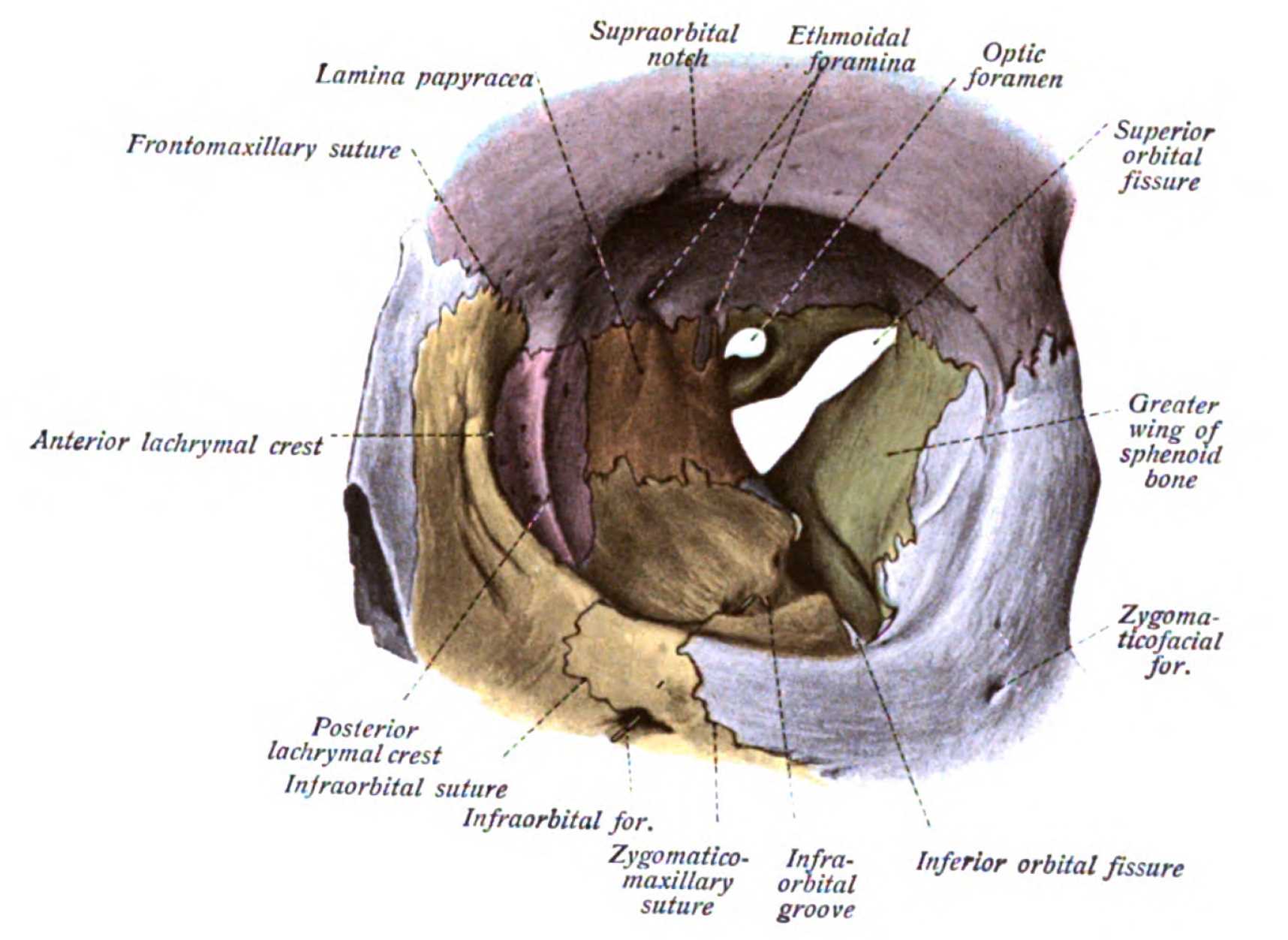 Orbit as seen from the front, with bones labeled in different colors, and superior orbital fissure at center as an "hour-glass" formation. 