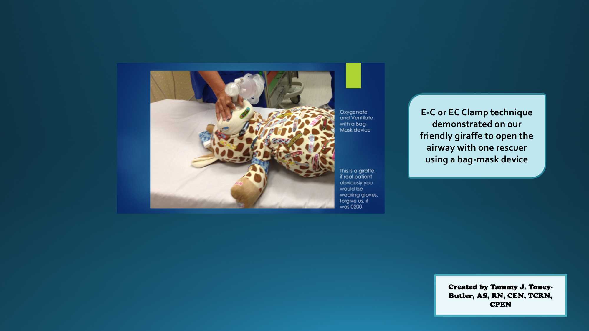 EC or E-C technique of opening an airway with one rescuer to facilitate bag-mask ventilation.