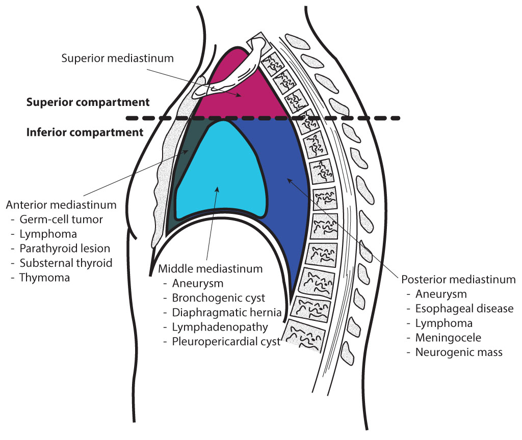 Superior mediastinum, anterior mediastinum, middle mediastinum, posterior mediastinum, Superior compartment, Inferior compartment,