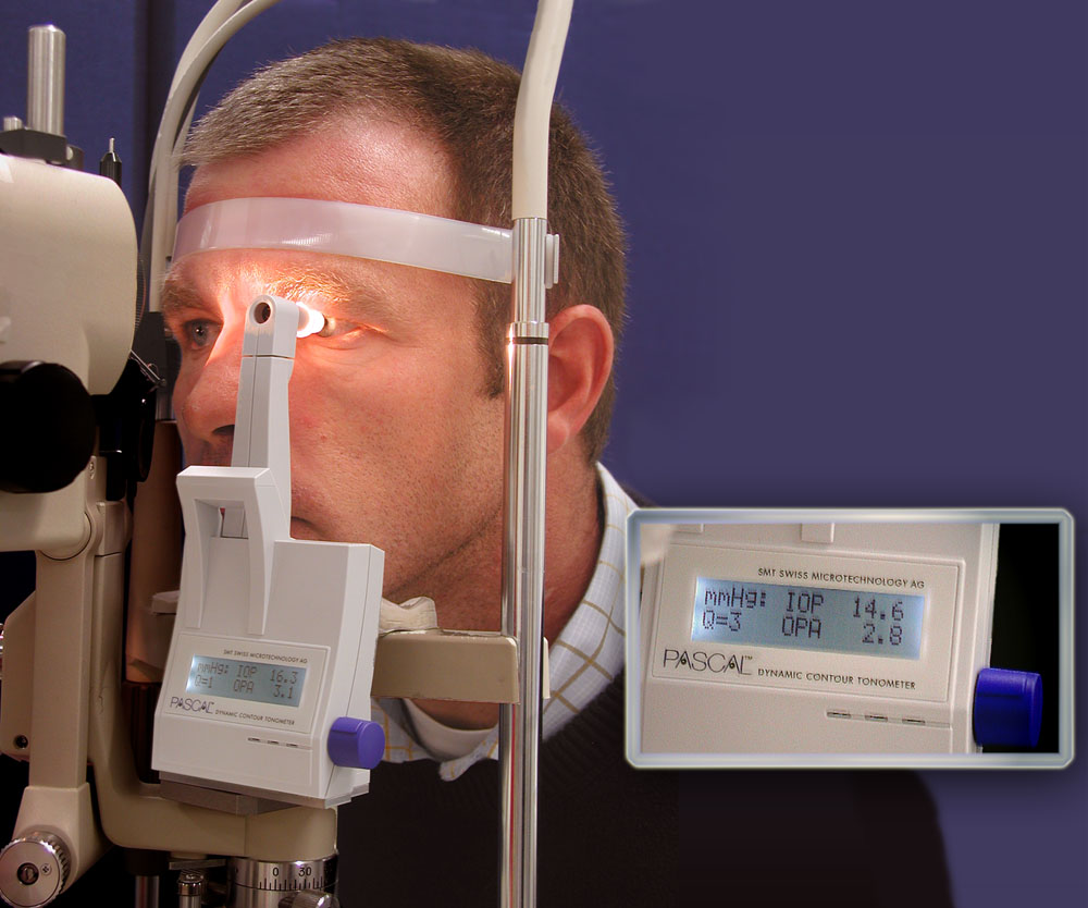 The PASCAL Dynamic Contour Tonometer. A monitor for detection of increased intraocular pressure.