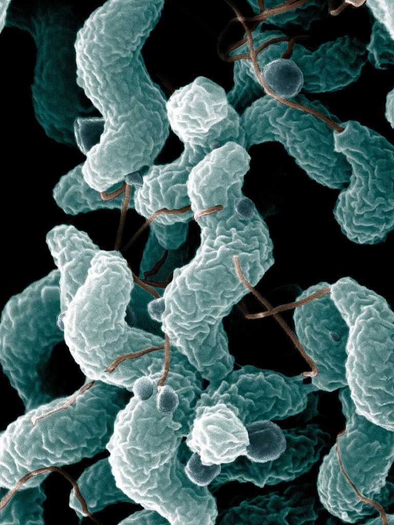 A scanning electron microscope-derived image of Campylobacter jejuni, which triggers about 30% of cases of Guillain–Barré syndrome.