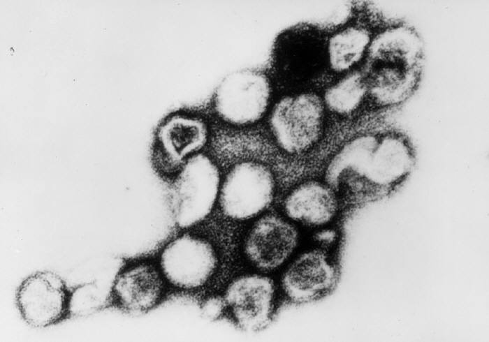 Transmission electron micrograph of rubella virus.