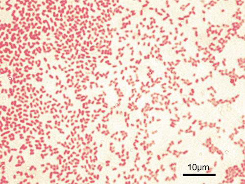 Microscopic image of gram-negative Pseudomonas aeruginosa bacteria (pink-red rods)