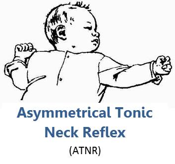 Asymmetrical Tonic Neck Reflex