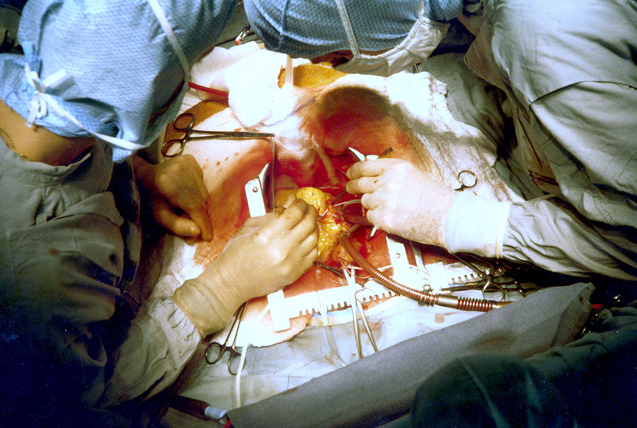 <p>Cardiac Surgery.&nbsp;Two surgeons are performing coronary artery bypass surgery.</p>