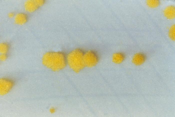 Clostridium difficile, Cycloserine mannitol agar, Antibiotic Associated Diarrhea (AAC) 