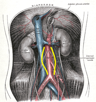 <p>Abdominal Aortic Aneurysm Illustration