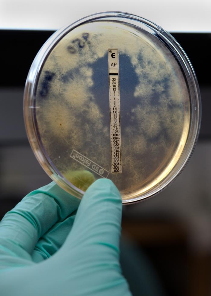 Culture Plate, Meningitis; Fungal, Ascomycota, Lab
