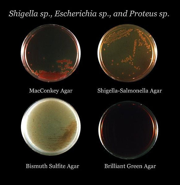 Four Different agar media culture inoculated with Shigella sp., Escherichia sp., and Proteus sp. bacteria, (clockwise: MacConkey, Shigella-Salmonella, Bismuth Sulfite, and Brilliant Green agars)