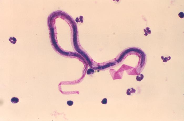 Photomicrograph, nematode, Brugia malayi, lymphatic filariasis, Parasitic diseases, Pathology, Nematode Infection