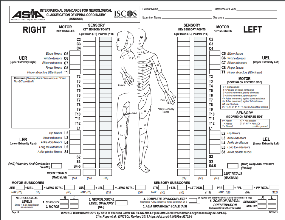 ASIA scoring sheet for determining level and extent of spinal cord injury. Useful for physical examination and assessment in all patients with spinal cord injury.