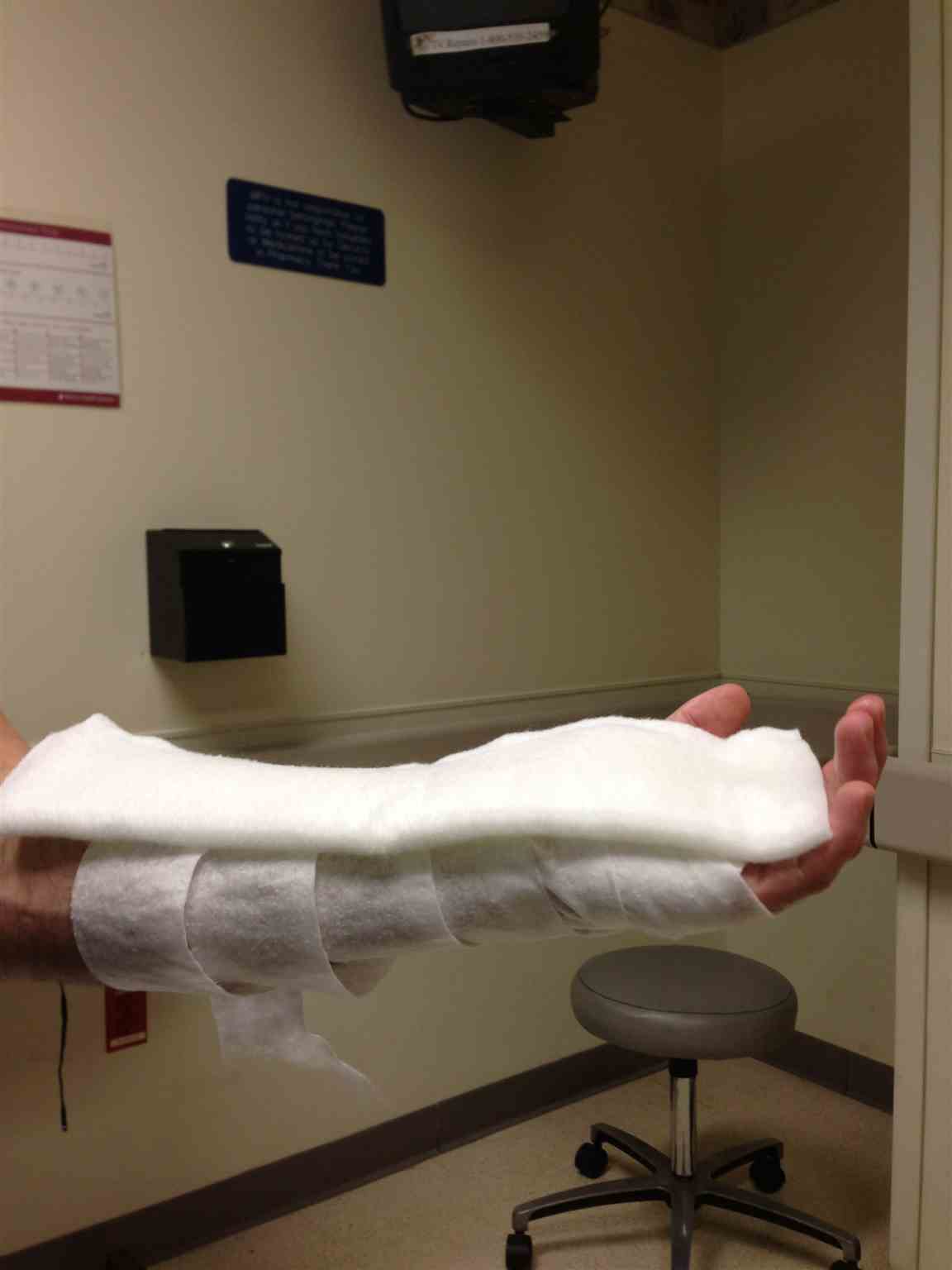 side view with padding and splint before elastic bandage