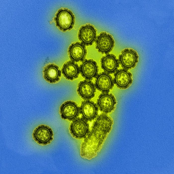 <p>Electron Microscopic View of H1N1 Influenza Virus Particles