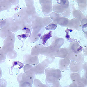 Image of T. cruzi, the cause of Chagas disease, in Giemsa stained blood smear.