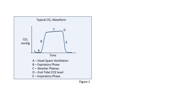 Figure 1 - CO2 waveform