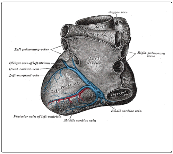 Fig 1. Schematic diagram depicting coronary sinus of the heart and its tributaries.