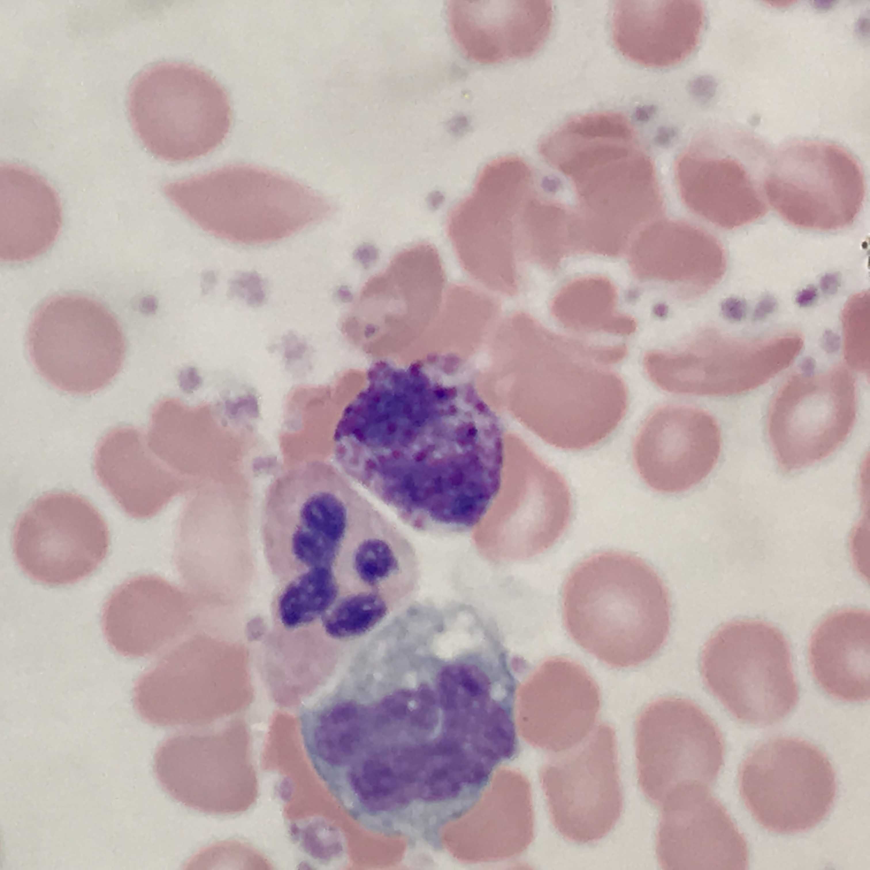 Basophil (center) with adjacent neutrophil and monocyte