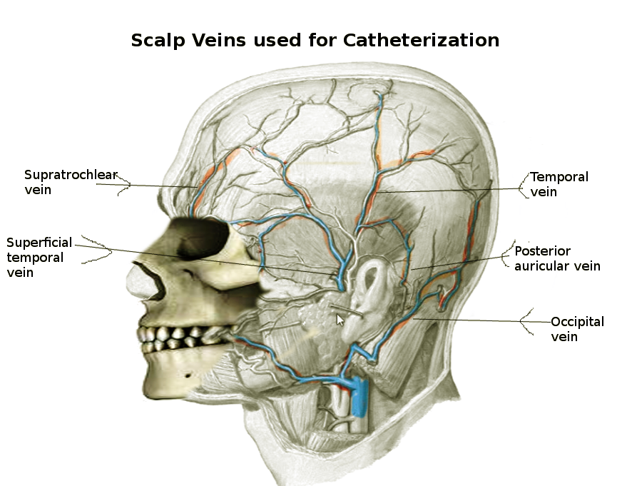 <p>Scalp Veins Used for Catheterization