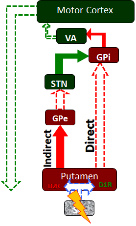 The basal ganglia circuitry as it is affected in Parkinson's disease.  Neurodegenerative loss of the substantia nigra (SN) and its dopaminergic projections to the putamen lead to a decrease in activity in the direct pathway and an increase in activity in the indirect pathway.  As a result, the subthalamic nucleus (STN) disproportionately stimulates the globus pallidus internus (GPi) which in turn inhibits the ventral anterior (VA) nucleus of the thalamus and a loss of activitation of the motor cortex and its corticospinal projections to the spinal cord alpha motor neurons.  These patients experience deficits in the initiation of motor movement along with poor balance control and changes in gait, along with other signs and symptoms.