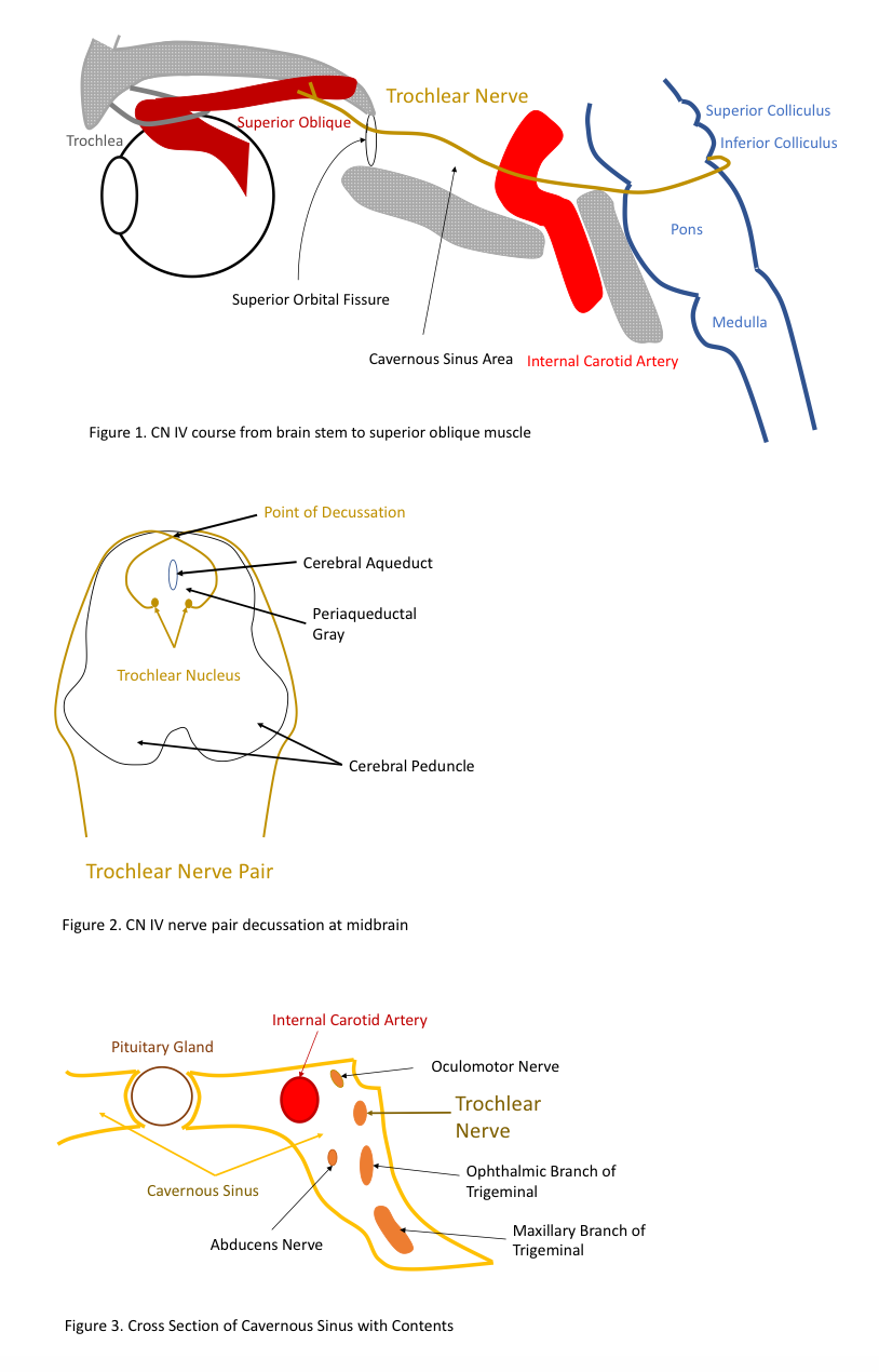 Figure 1. CN IV course from brain stem to superior oblique muscle; Figure 2. CN IV nerve pair decussation at midbrain; Figure 3. Cross Section of Cavernous Sinus with Contents