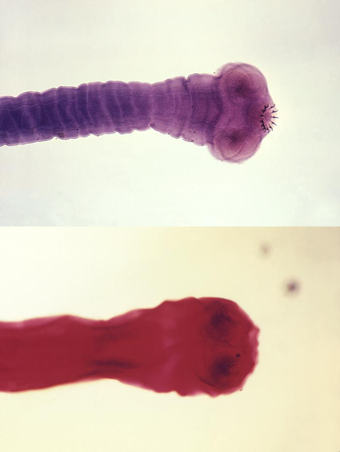 Scolex of the Taenia Saginata and Taenia Solium, Pork Tapeworm (top) and Beef Tapeworm (bottom) 