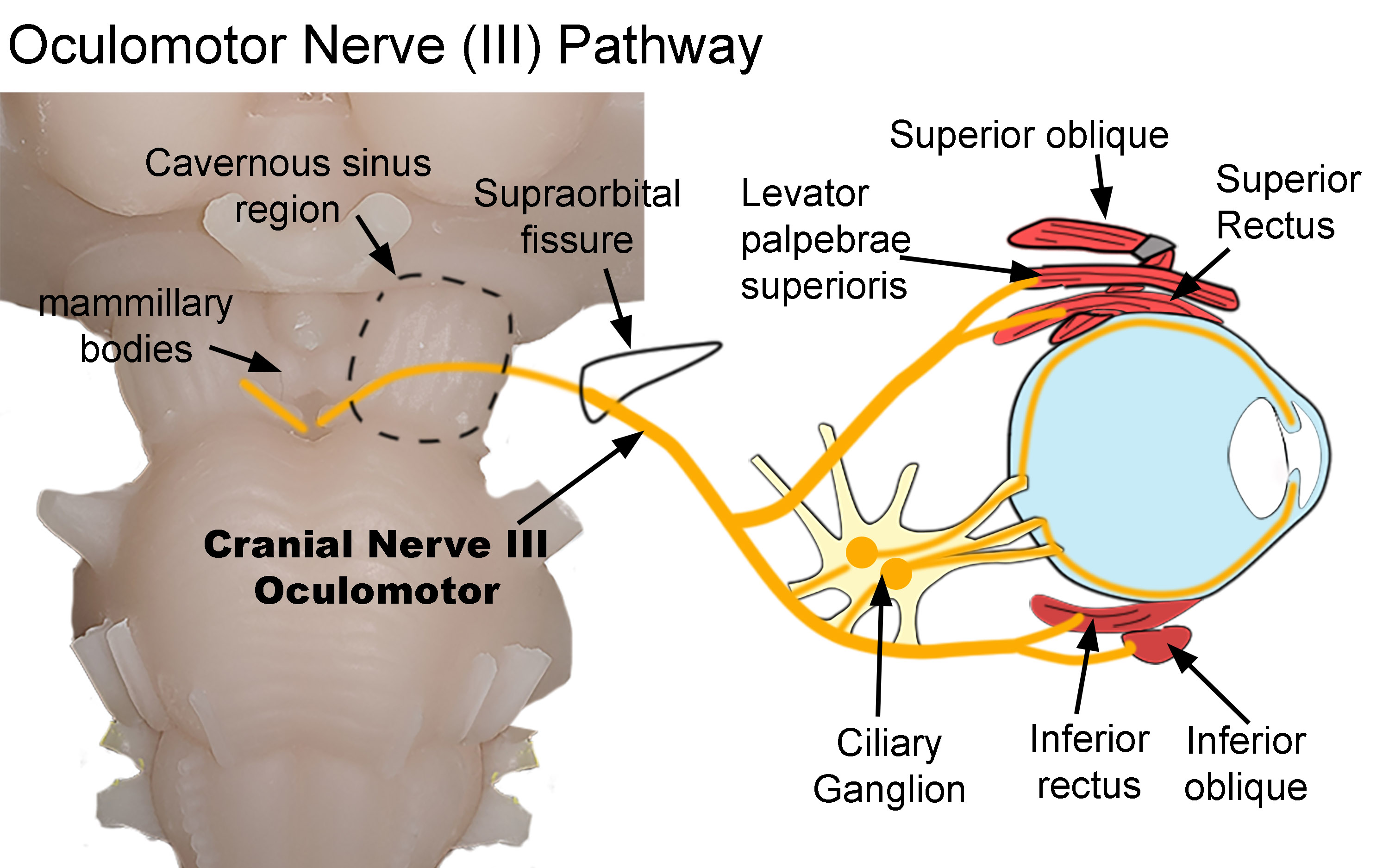Pathway of the Oculomotor Nerve (III). Diagram shows the pathway of the oculomotor nerve as it exits the brainstem and terminates within the orbit. After exiting the brainstem, it traverses both the cavernous sinus (dotted line) and supraorbital fissure (black line) before entering the orbit. Parasympathetic nerves synapse within the ciliary ganglion. Postganglionic nerves then innervate the sphincter papillae and ciliary muscles. Somatic nerves innervate the superior oblique, levator palpebrae superioris, superior rectus, inferior rectus, and inferior oblique muscles. 