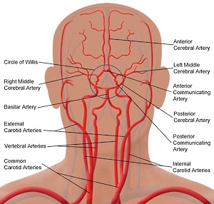 The figure shows the cerebral vascular system.
