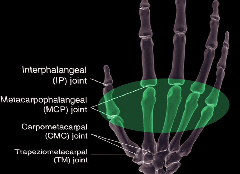 Metacarpal joint