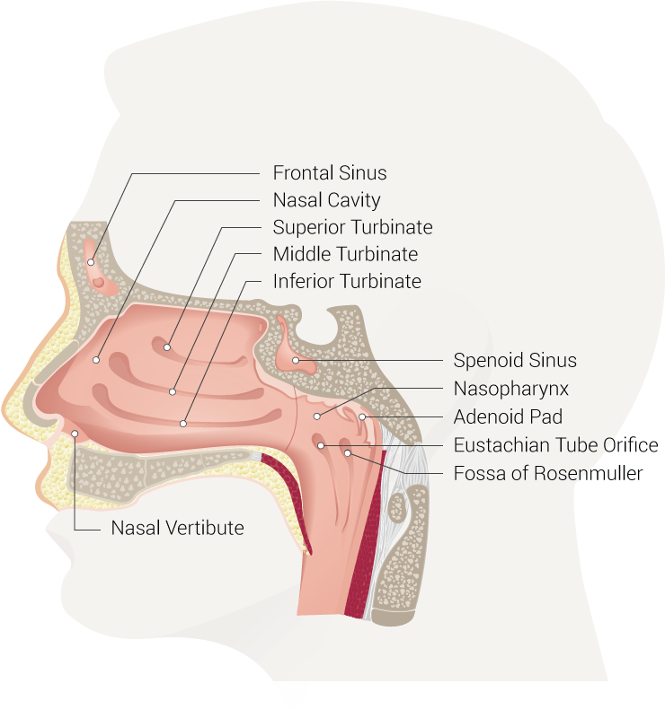 Nasal Cavity, Frontal Sinus, Superior Turbinate, Middle Turbinate, Inferior Turbinate, Spenoid Sinus, Nasopharynx, Adenoid Pad, Eustachian Tube Orifice, Fossa of Rosenmuller, Nasal Vertibute