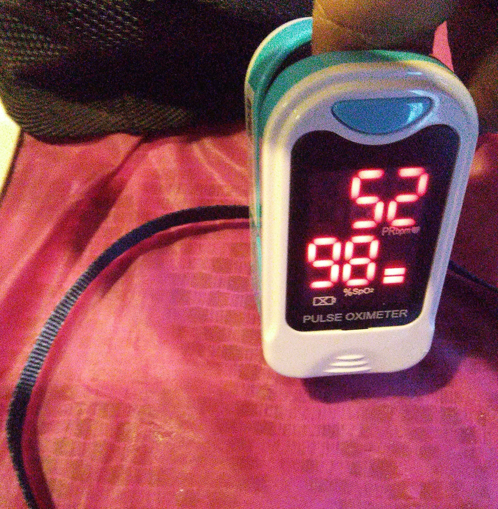 This image show a Pulse Oximeter with 98% oxygen saturation level and pulse/HR of 52 bpm.