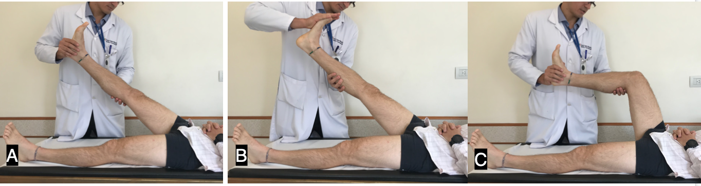 Figure 1.A) Straight leg raise test. B) Bragaad’s Test to increase the test sensitivity. C) When flexing the knee the patient usually experience pain relief.
