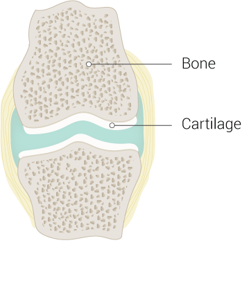 Cartilage, Bone