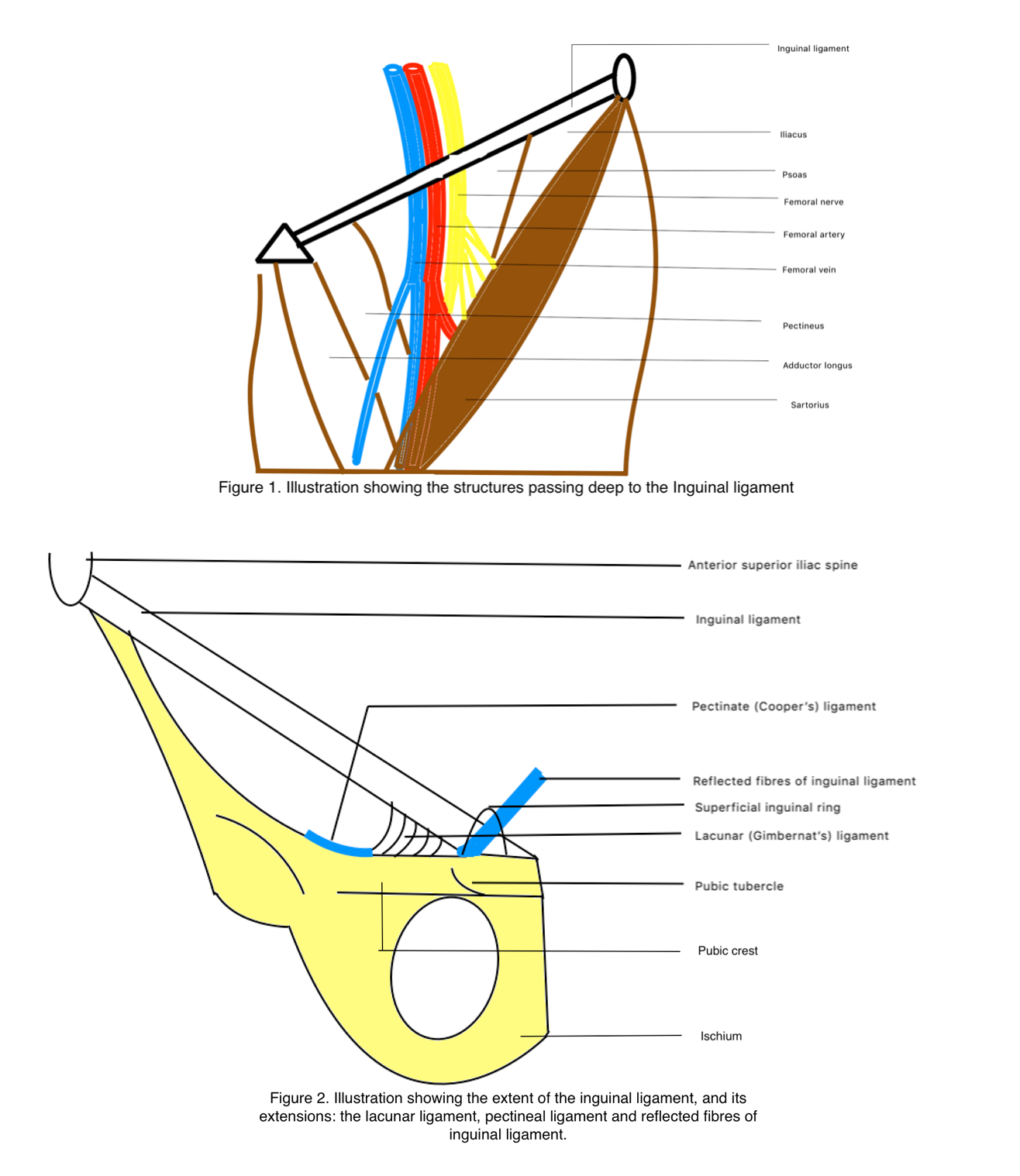 Figure 1: Structures passing deep to inguinal ligament
Figure 2: Extent and extensions of inguinal ligament