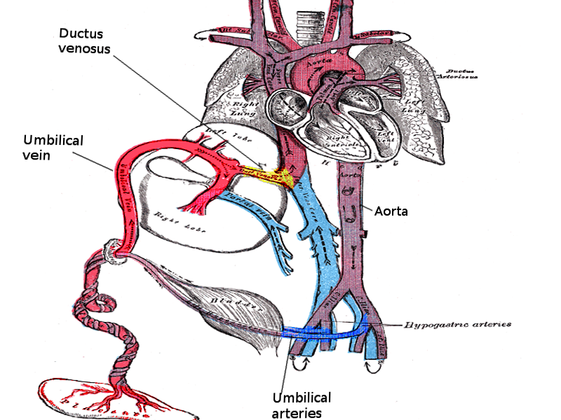Umbilical Artery Catheterization